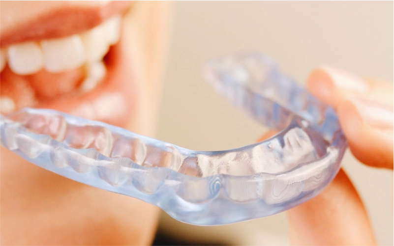 Férula dental Odentia laboratorio dental en Bilbao